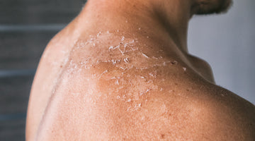 What Should I do If I have Dry Skin?